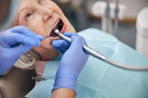 How Much Is Your Medicare Advantage Plan’s Free Dental Care Really Worth?